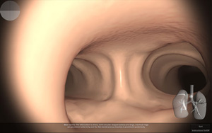 virtual nerve block screen shot